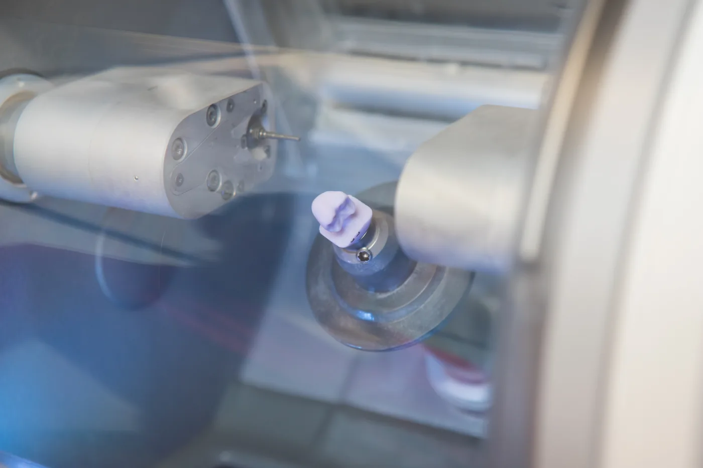 CEREC: Keramikrestauration aus eigener Herstellung
